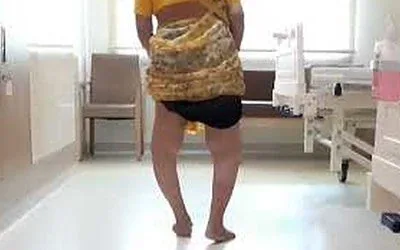 Bilateral Total Knee Replacement