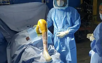 What has Changed in regard to Joint Replacement? Technique vs Technology